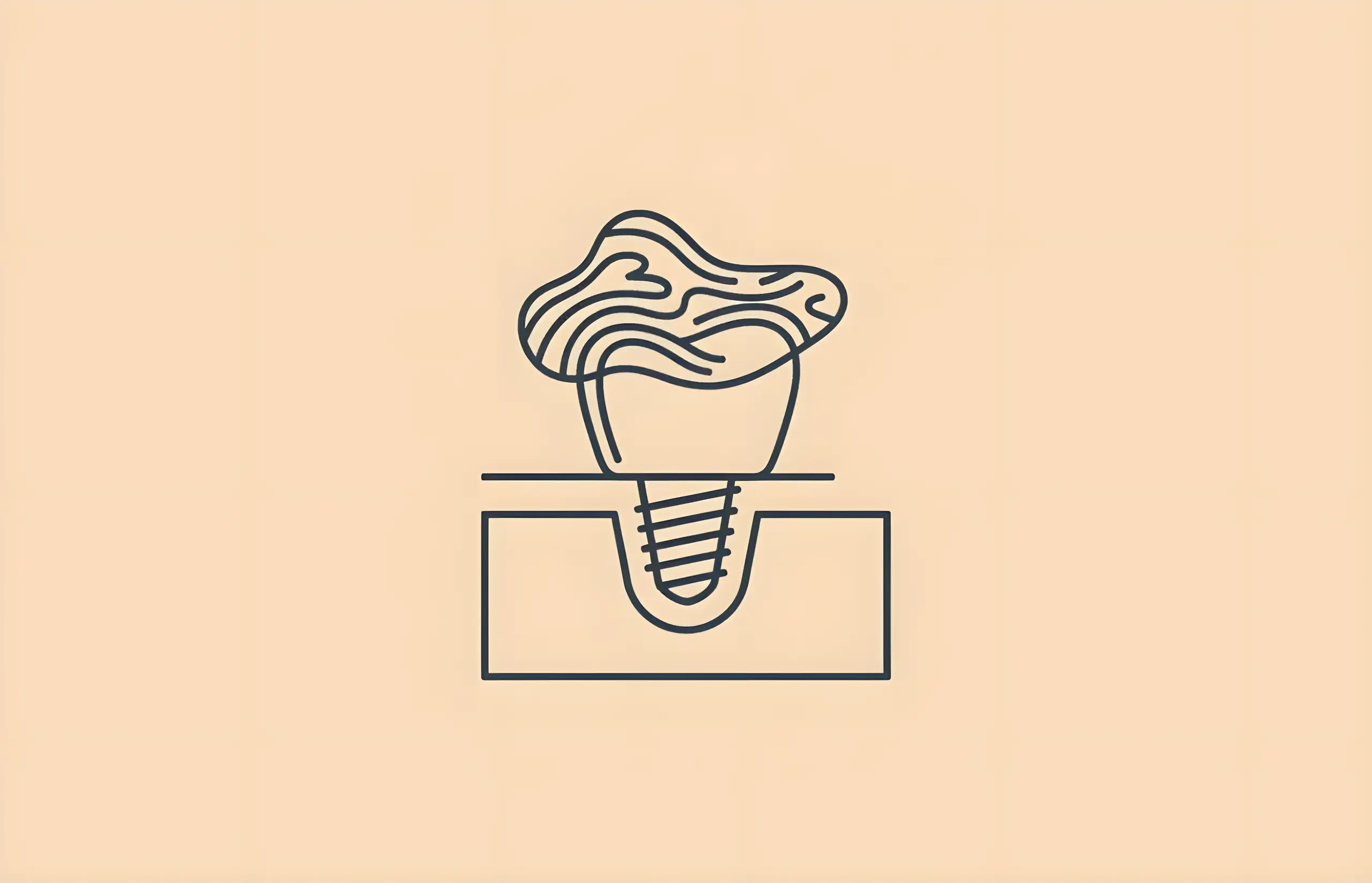 What Is The Best Bone Graft Material For Dental Implants?