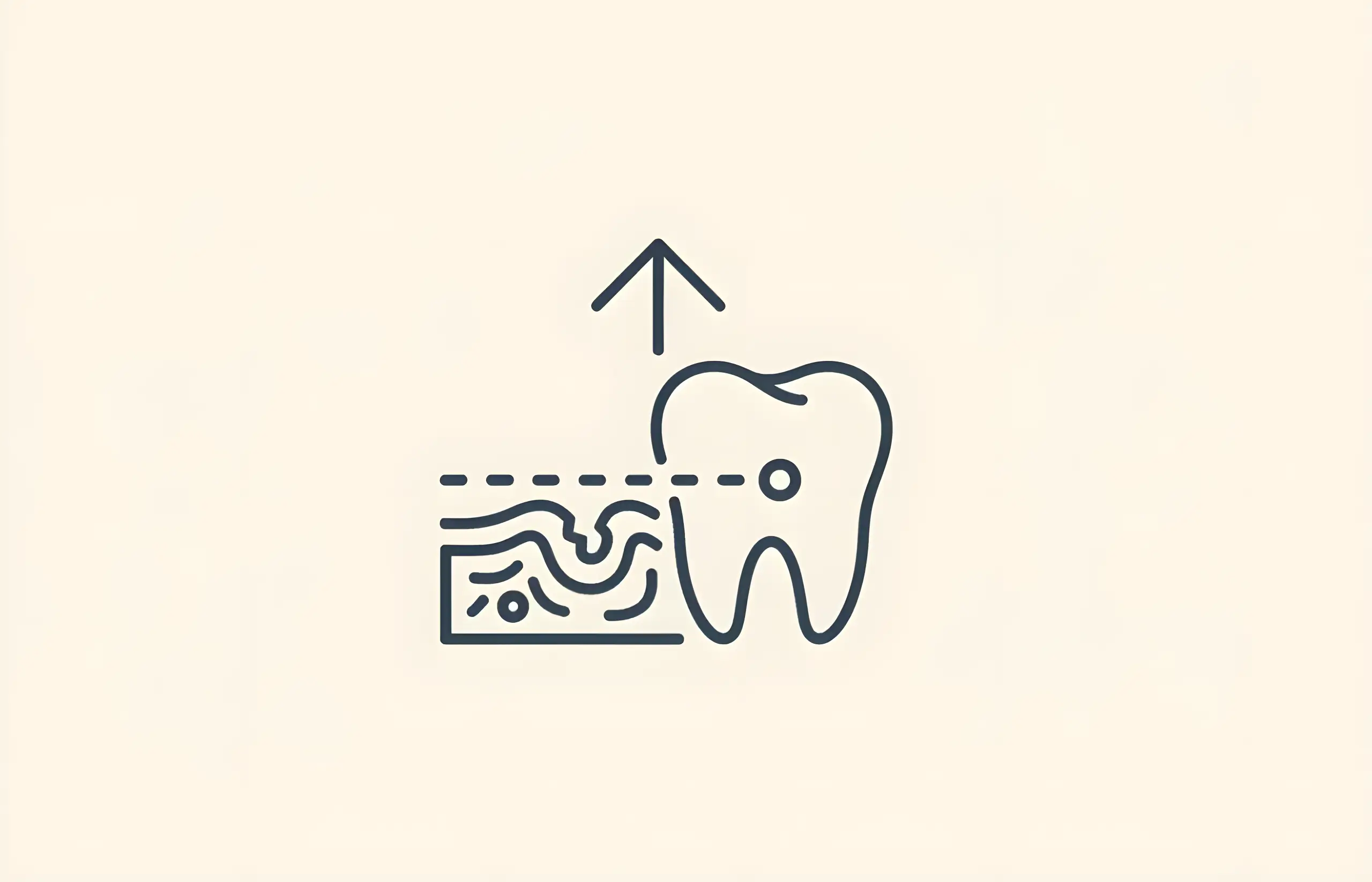 Can You Have Dental Implants With Gum Disease?