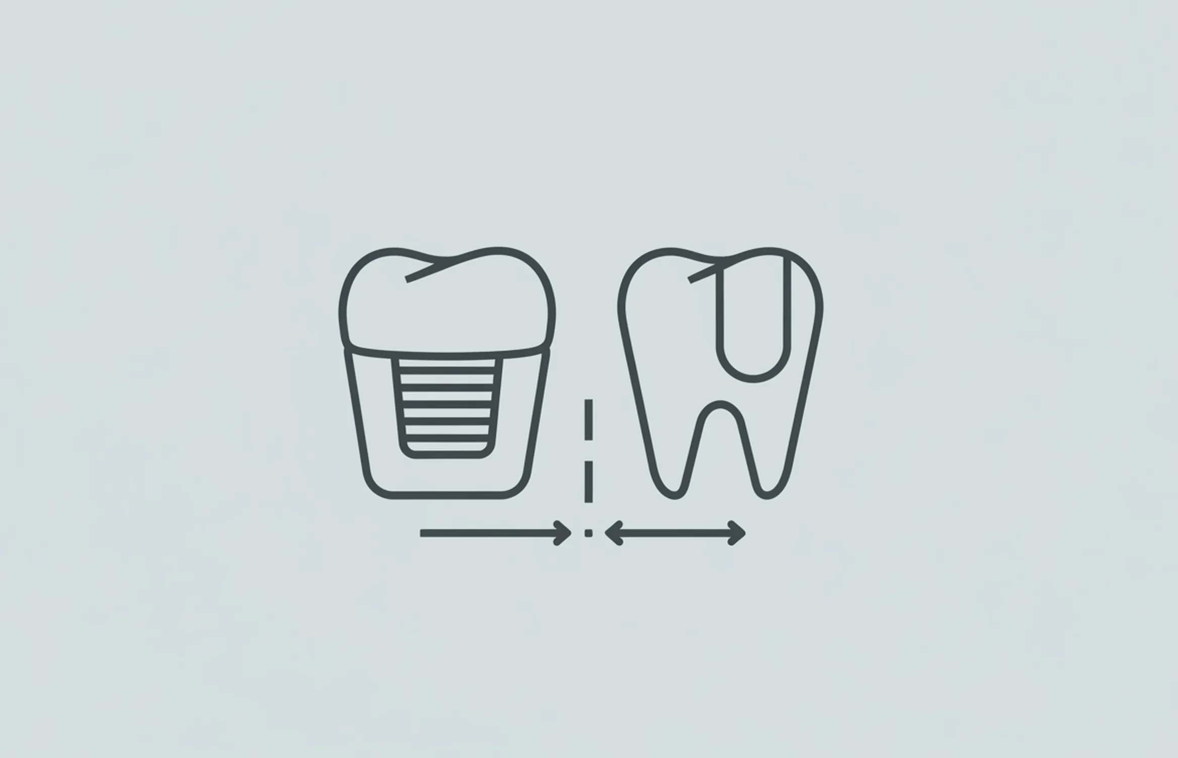 Capped Teeth vs Veneers