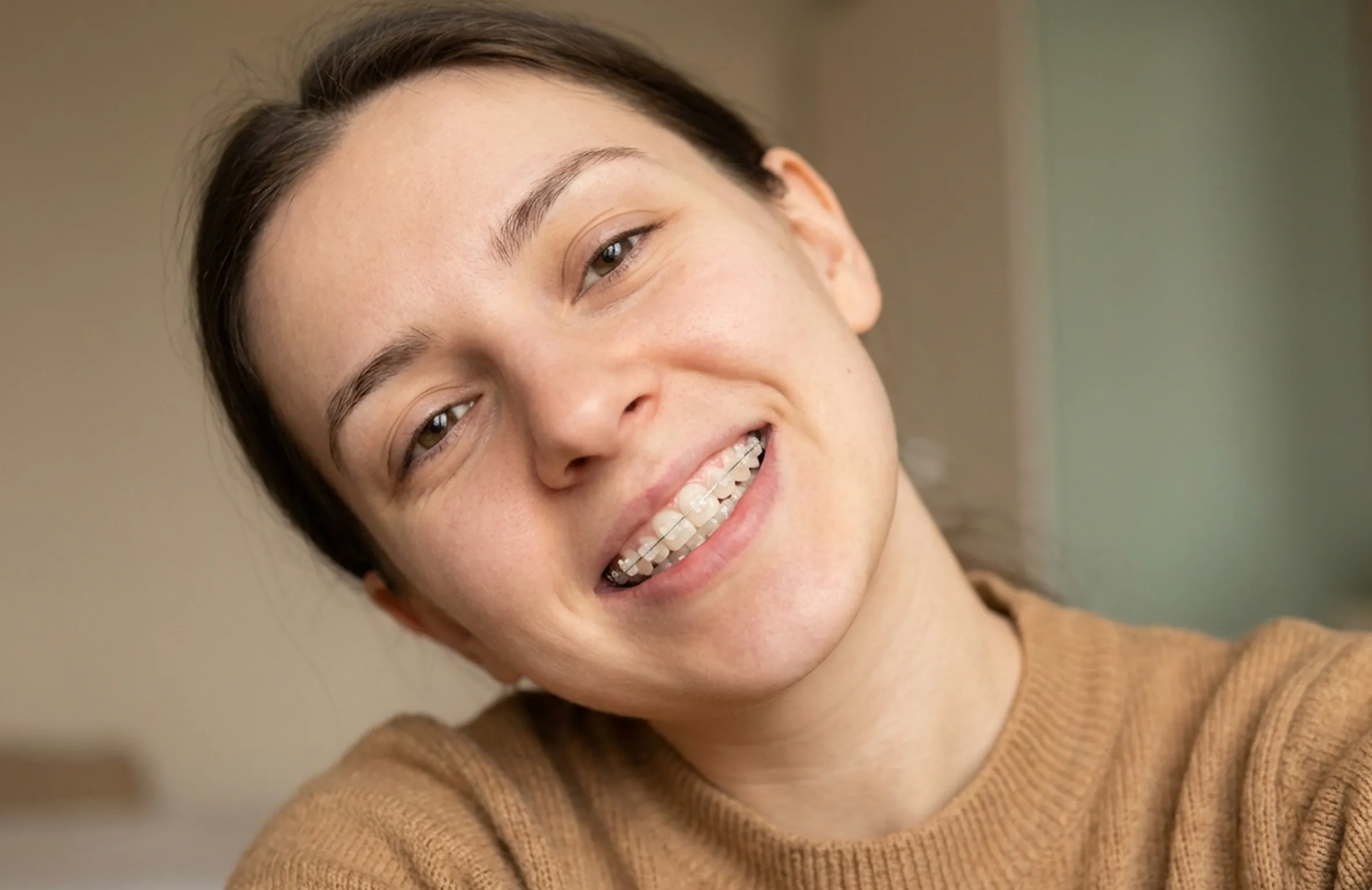 A Guide to Ceramic Braces