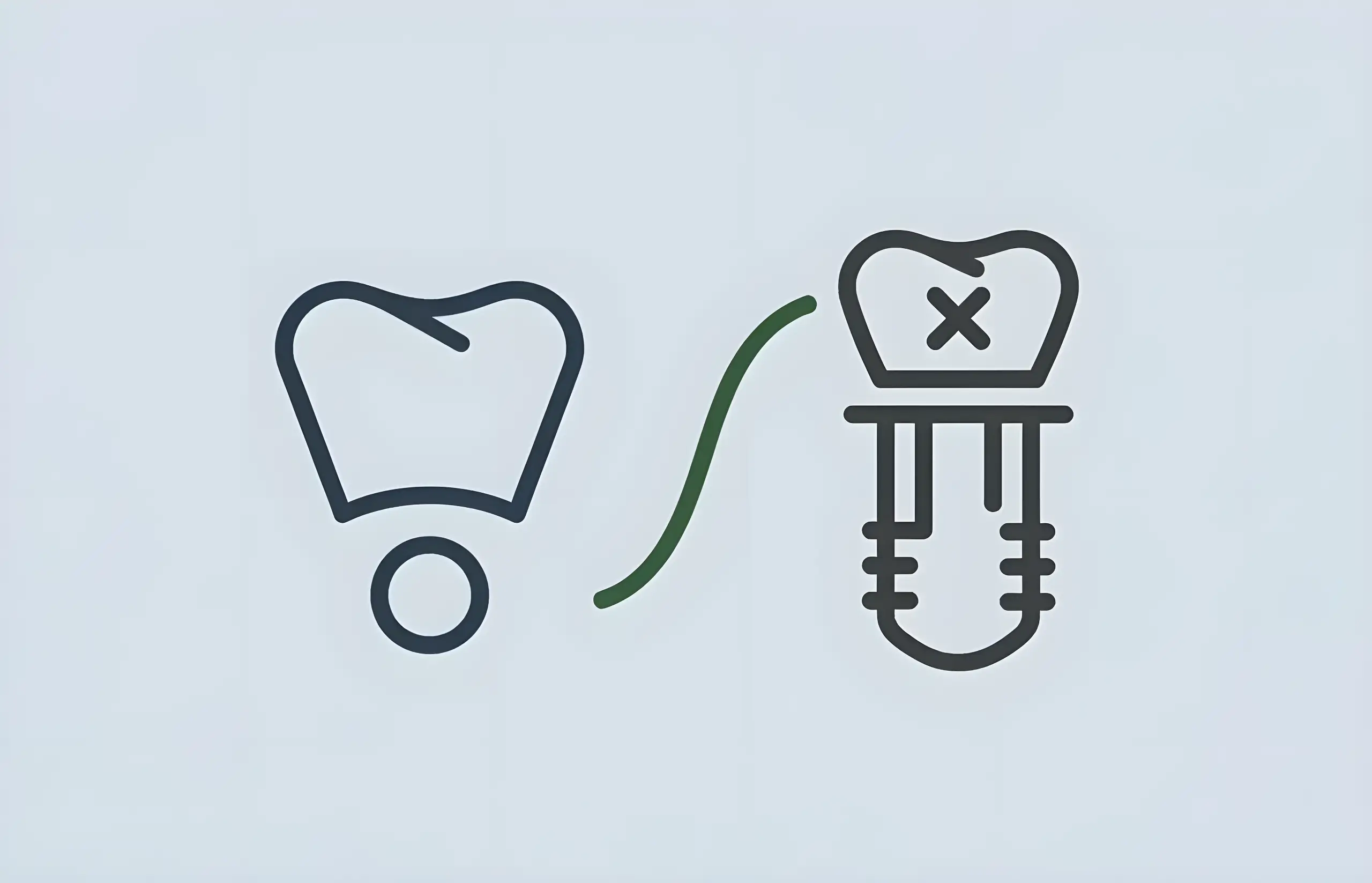 Dental Crown vs Implants