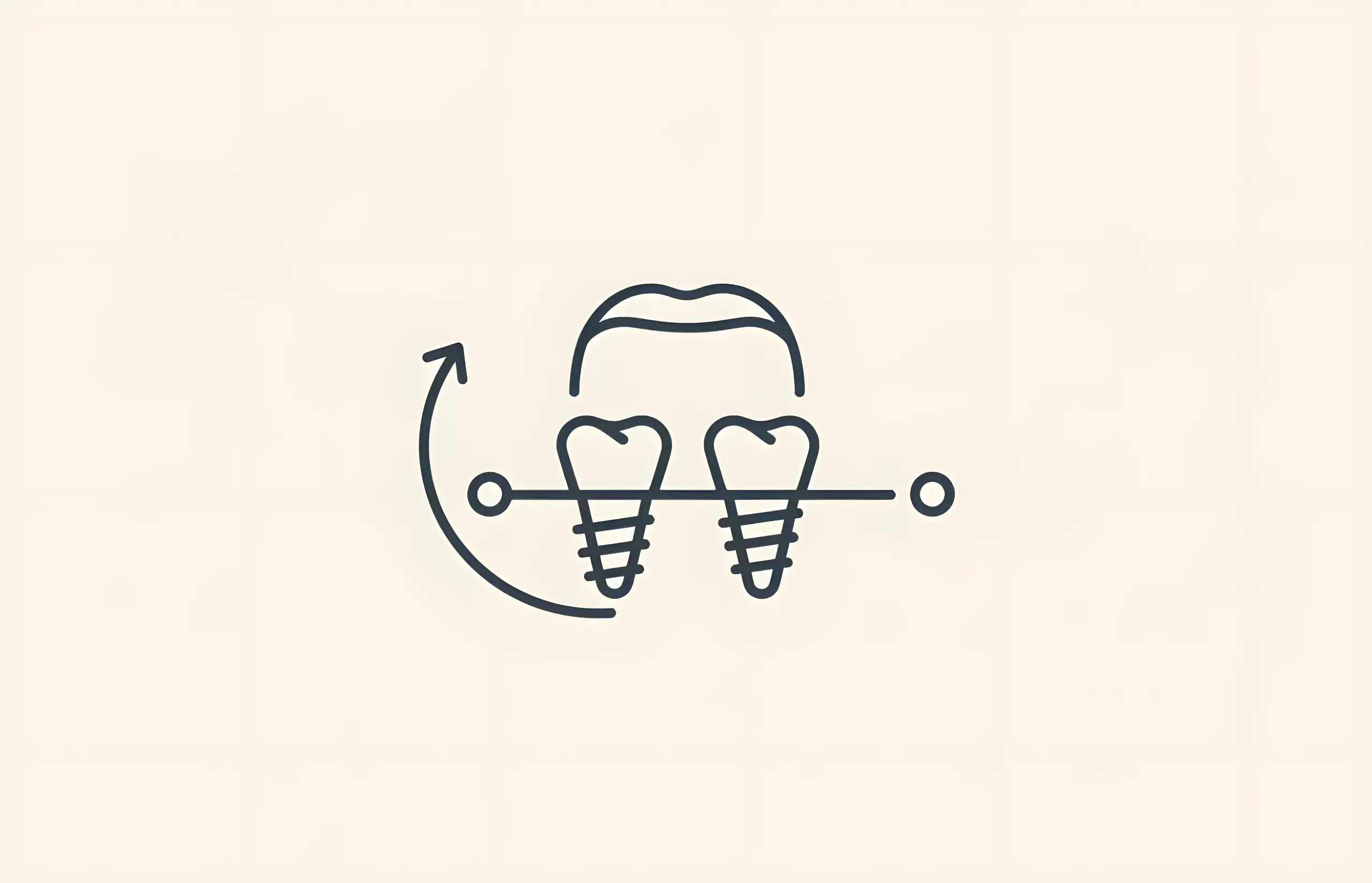 How Long Do Mini Dental Implants Last?